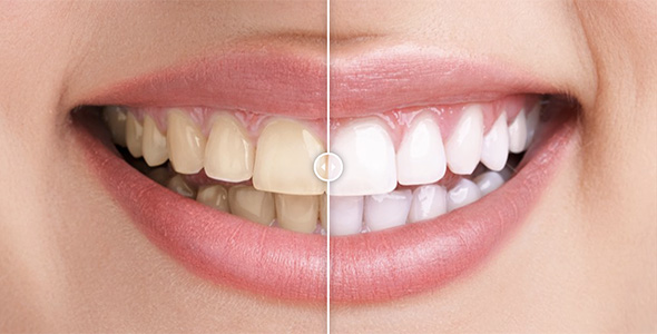Before & After Images Comparison WordPress Plugin 1 Before & After Images Comparison WordPress Plugin